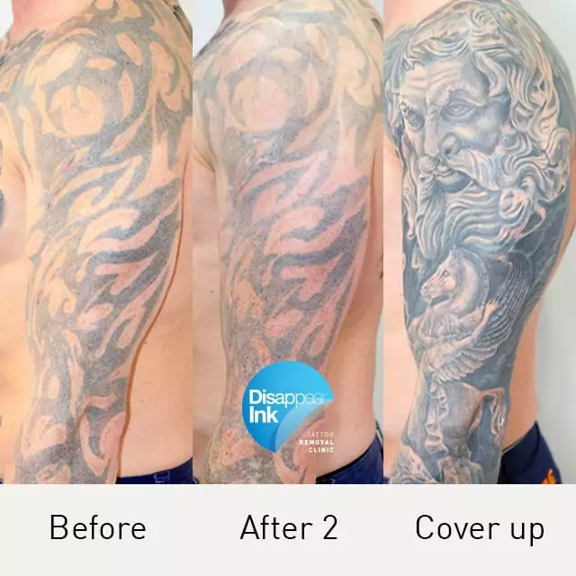 How Does a Tattoo Cover Up Work?