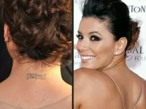 Celeb tattoo removal