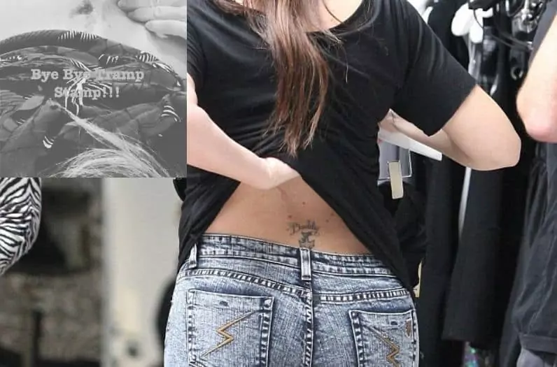 Celeb tattoo removal