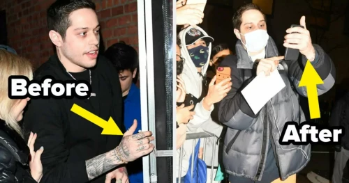 Celeb tattoo removal