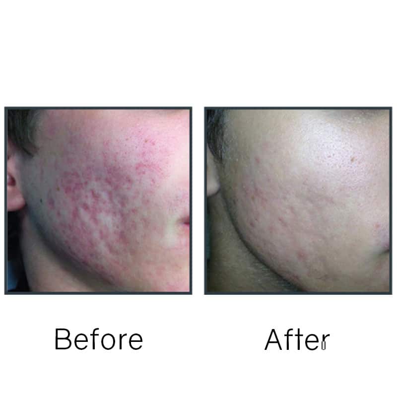 Before/After