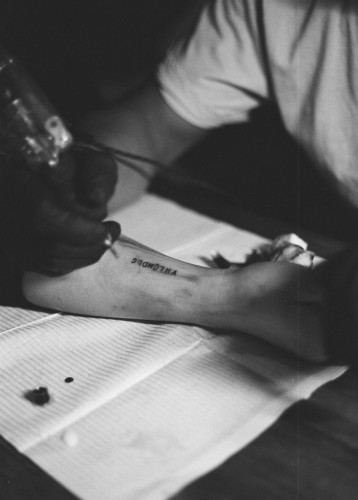 When Is The BEST Time To Start Laser Tattoo Removal?