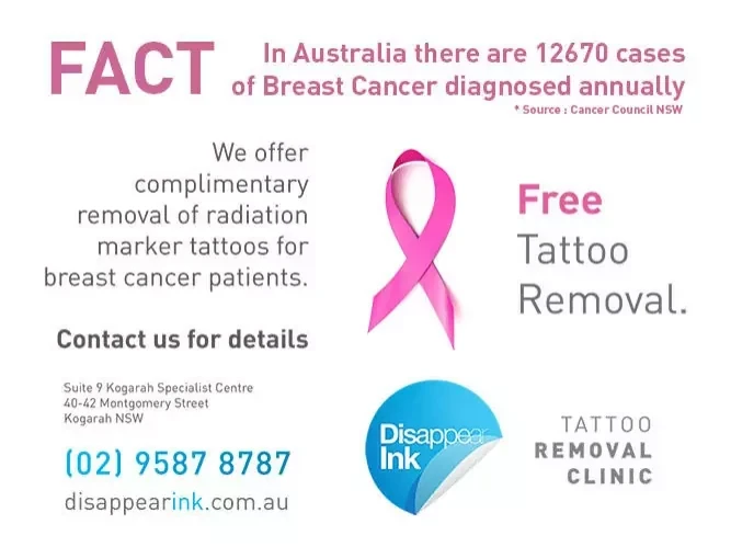 Breast Cancer Radiation Marker Tattoos – A Complimentary Treatment