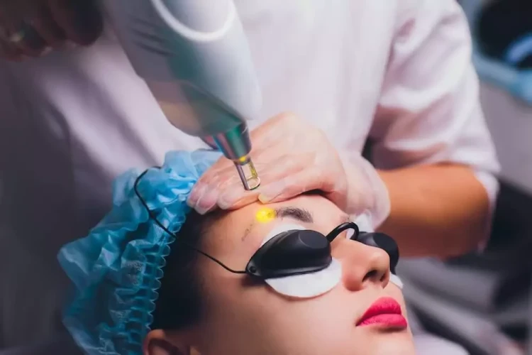 Your 7 Big Questions About Eyebrow Tattoo Removal