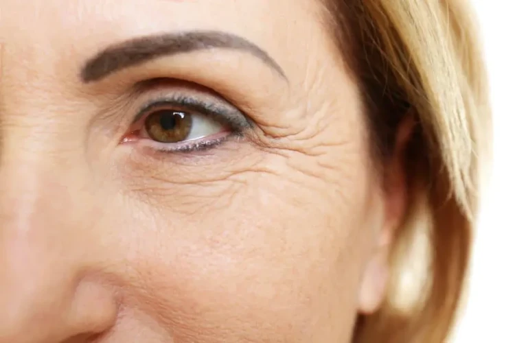 The 5 Main Causes Of Wrinkles Explained